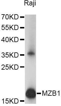 Polyclonal Rabbit anti-Human MZB1 Antibody (WB)