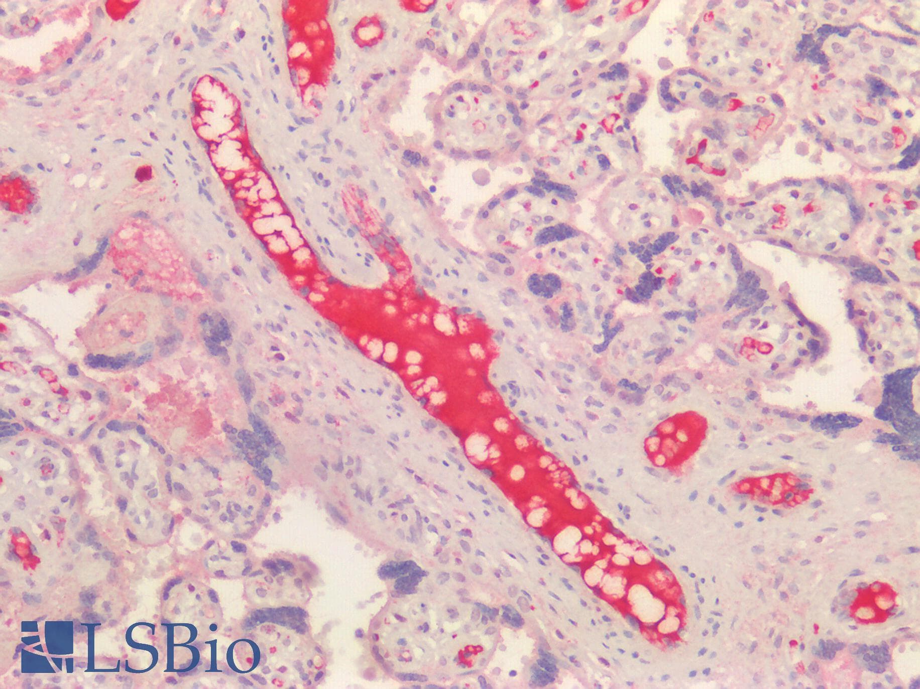 SCN9A / Nav1.7 Antibody