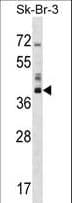 HSD17 / HSD17B1 Antibody (aa227-256)