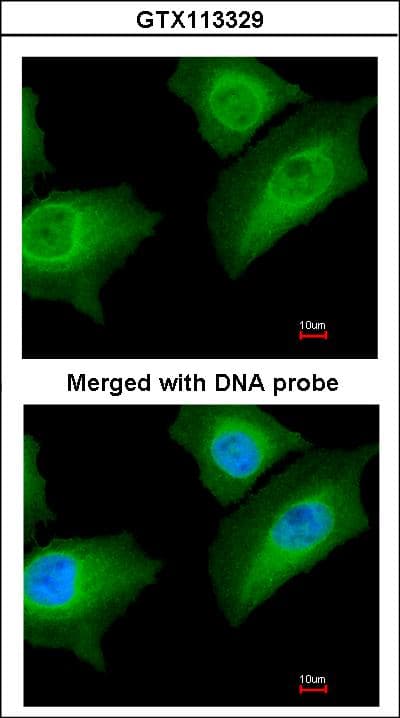 ANXA1 / Annexin A1 Antibody (aa1-228)