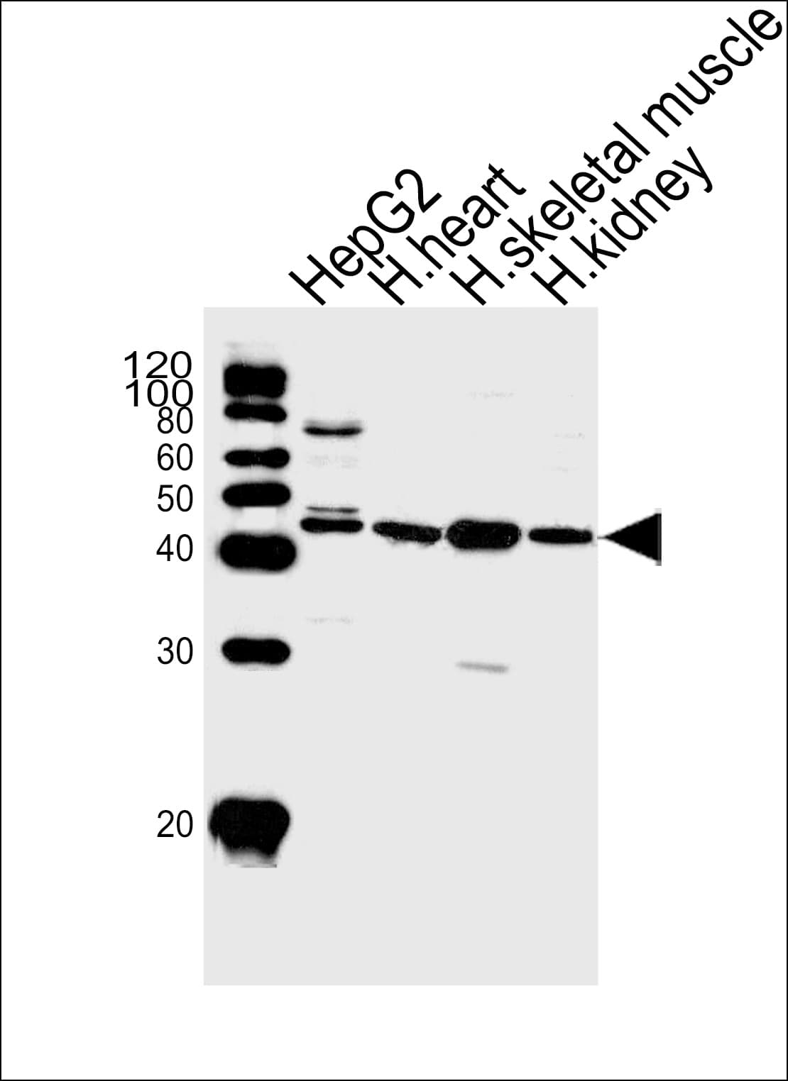 Polyclonal Rabbit anti-Human SPHK / SPHK1 Antibody (aa59-89, IHC, WB)