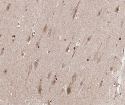 CCNB1 / Cyclin B1 Antibody (phospho-Ser126)