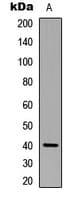 P40PHOX / NCF4 Antibody (Internal)