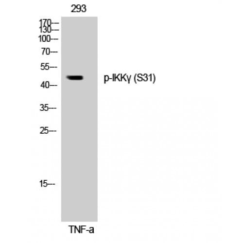 IKBKG / NEMO / IKK Gamma Antibody (10-90 aa)