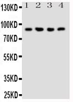 Polyclonal Rabbit anti-Human NRG2 Antibody (aa289-306, WB)