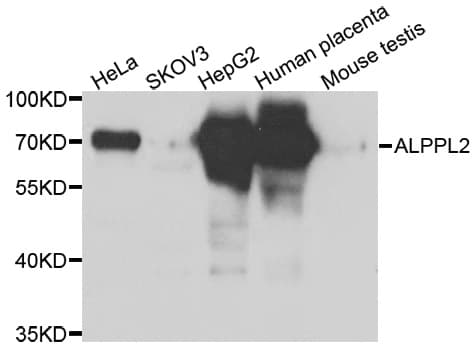 Polyclonal Rabbit anti-Human ALPPL2 Antibody (IHC, WB)