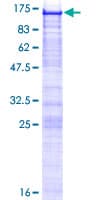 Human WBP11 Protein (Recombinant GST)