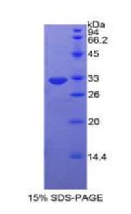 Human PRKCH / PKC-Eta Protein (Recombinant His)