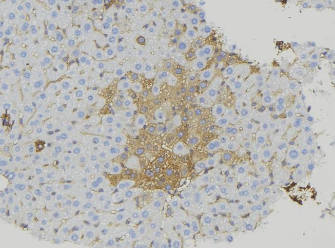 Polyclonal Rabbit anti-Human CABP7 Antibody (IHC, IF, WB)