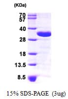 Human CHMP2A Protein (Recombinant His)
