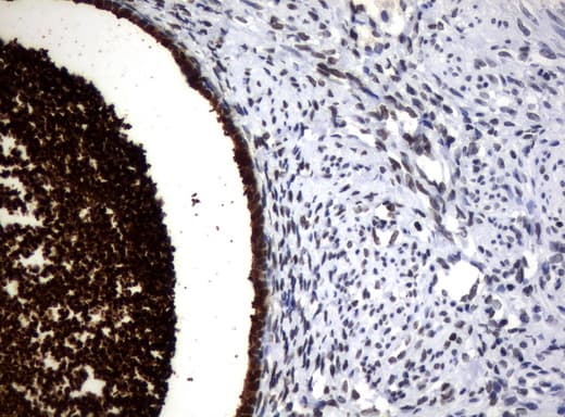 WFDC2 / HE4 Antibody (aa31-124, clone UMAB87)