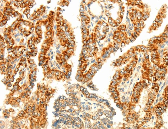 AARS2 Antibody