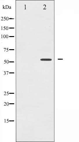 Polyclonal Rabbit anti-Human PPARG / PPAR Gamma Antibody (phospho-Ser112, IHC, IF, WB)