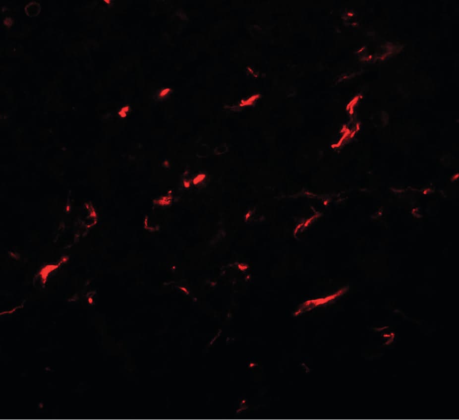 IHC-plus™ FMNL1 Antibody