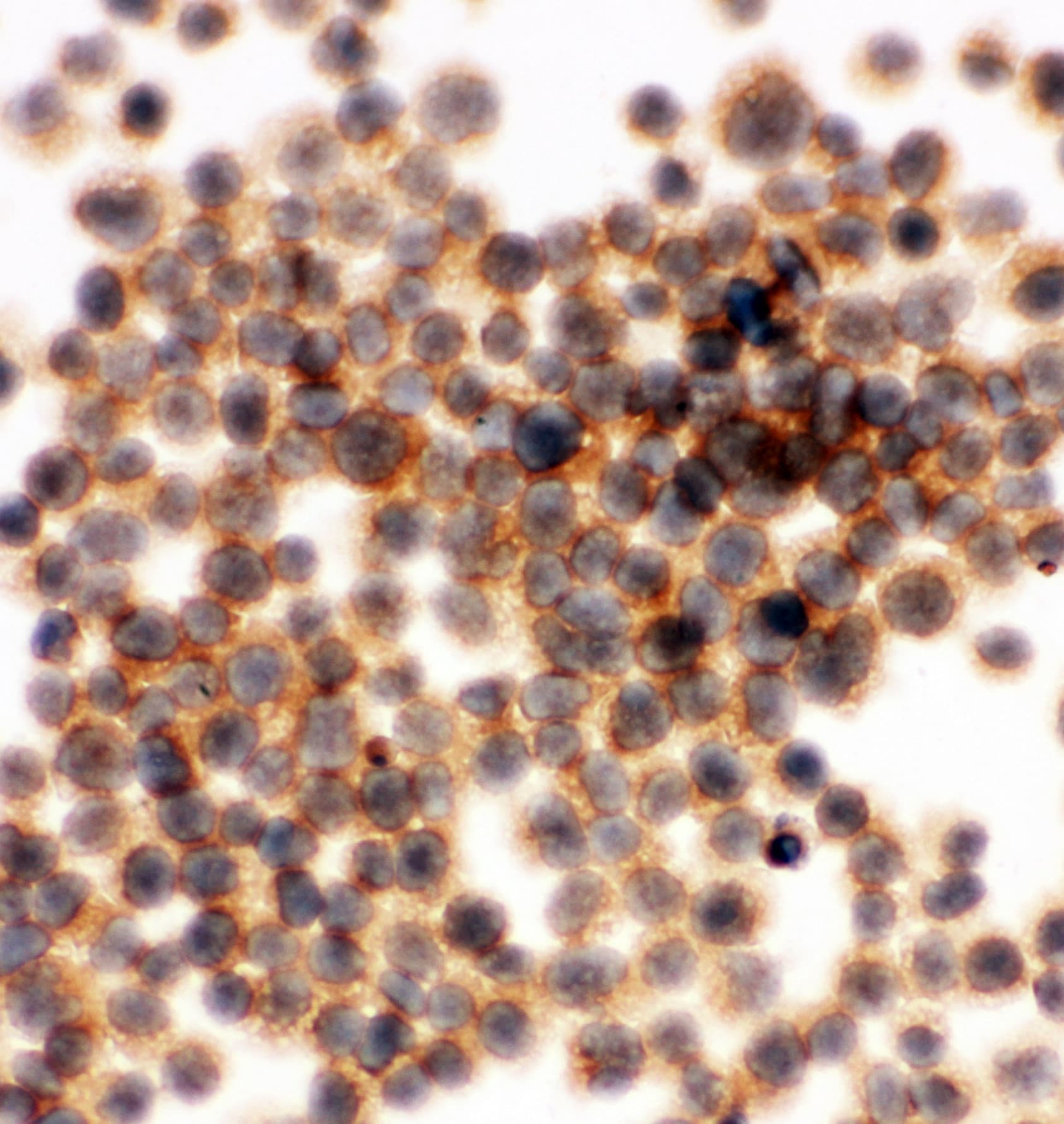 APBB1IP / RIAM Antibody (aa647-666)