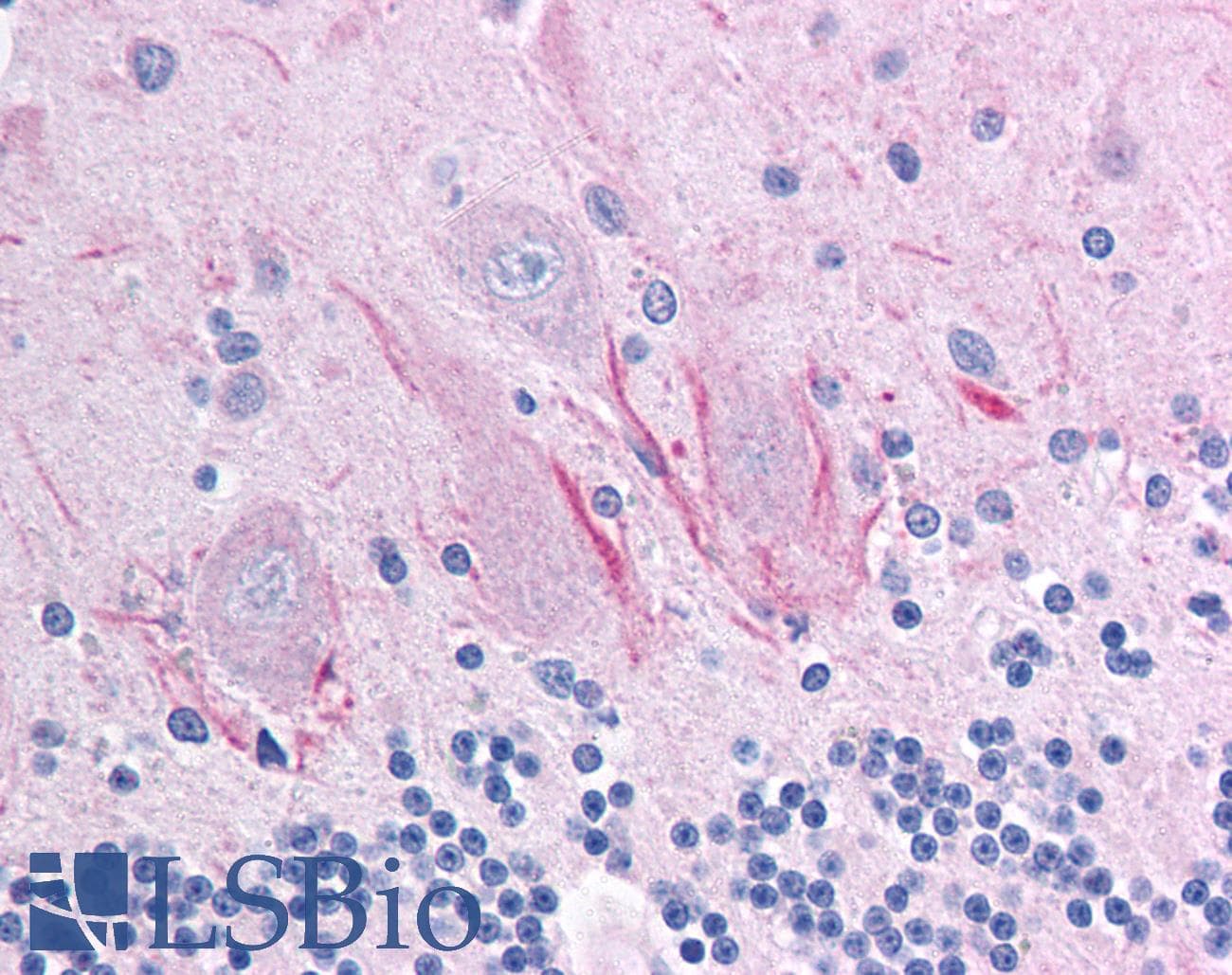IHC-plus™ Polyclonal Rabbit anti-Human MMP27 Antibody (aa445-459, IHC)