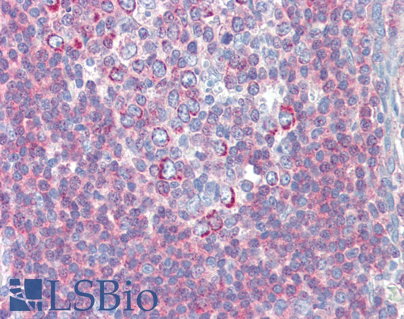 Polyclonal Rabbit anti-Human BACH2 Antibody (C-Terminus, IHC, WB)