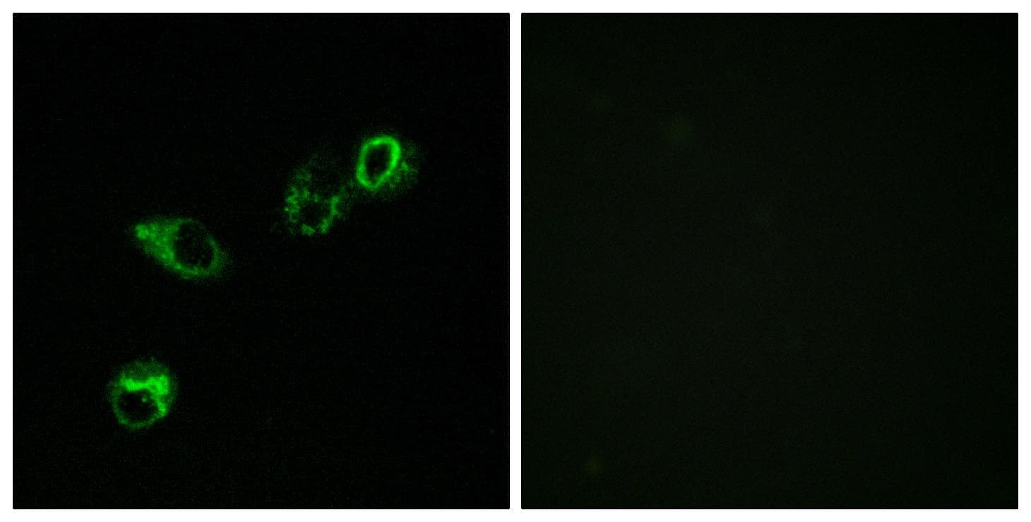 ACKR4 / CCRL1 / CCR11 Antibody