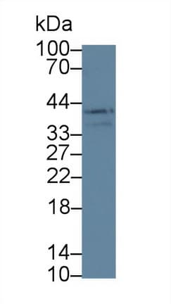 LOXL3 Antibody (aa519-726, PE)
