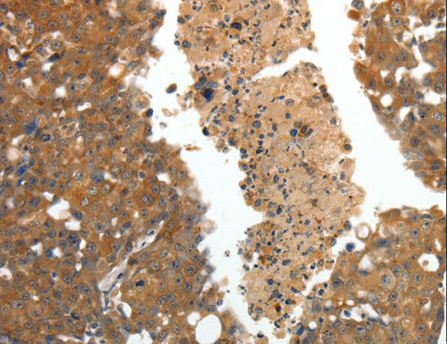 Polyclonal Rabbit anti-Human CRP / C-Reactive Protein Antibody (IHC, WB)