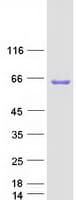 Human CECR1 Protein (Recombinant Myc-DDK (Flag))