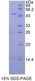 Human NCL / Nucleolin Protein (Recombinant His-GST)