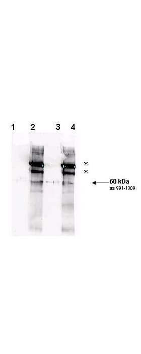 Polyclonal Rabbit anti-Saccharomyces cerevisiae Yeast Rad9 Antibody (phospho-Ser1260, WB)