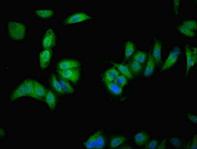 Polyclonal Rabbit anti-Human VMO1 Antibody