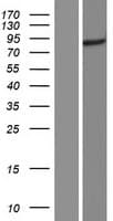 Human CENPI / CENP-I Protein (Over-Expression Lysate Myc-DDK (Flag))