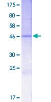 Human CRIP3 Protein (Recombinant GST)
