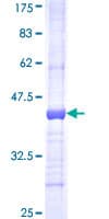 Human GBE1 Protein (Recombinant GST, N-terminus)
