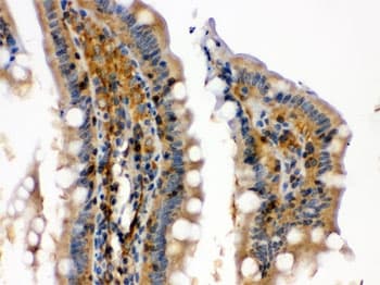 Polyclonal Rabbit anti-Human RAB13 Antibody (IHC, WB)
