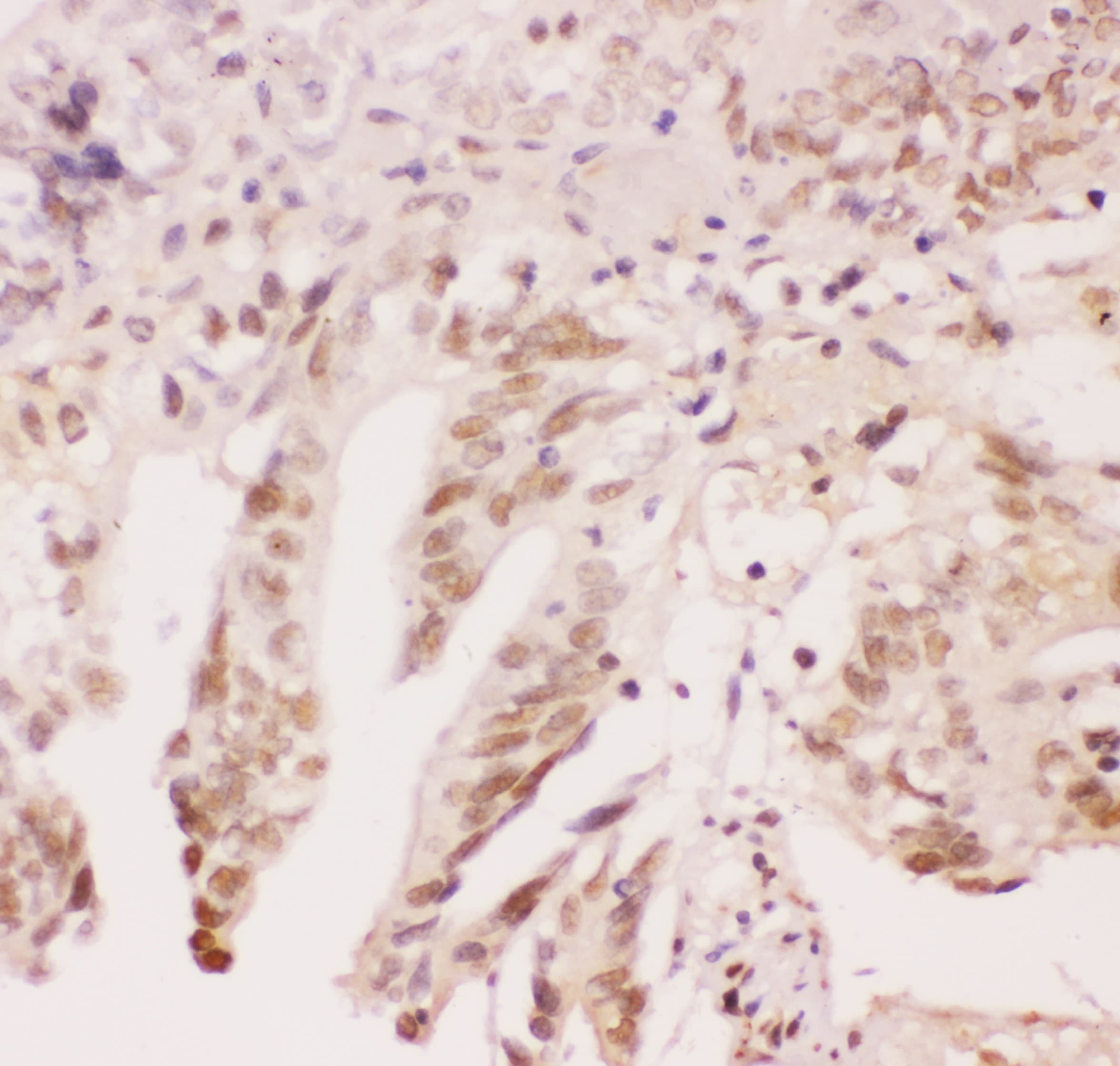 ATF1 Antibody (aa1-271)