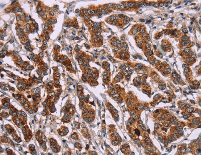 Polyclonal Rabbit anti-Human ID2 Antibody (IHC)