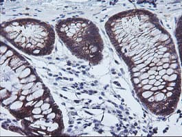 CAST / Calpastatin Antibody (clone OTI1E7)