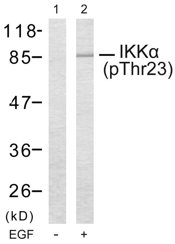 Polyclonal Rabbit anti-Human CHUK / IKKA / IKK Alpha Antibody (phospho-Thr23, IHC, WB)