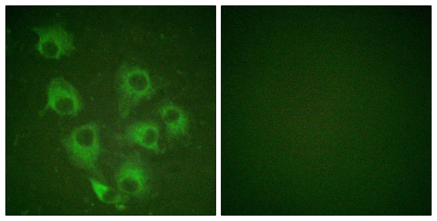 CRKL Antibody (phospho-Tyr207)