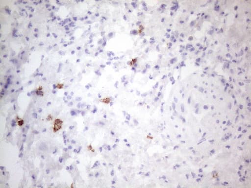 Monoclonal Mouse anti-Human c-Kit / CD117 Antibody (clone OTI2B12, aa27-308, IHC, WB)