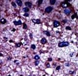 PFKM / PFK-1 Antibody (aa122-151)