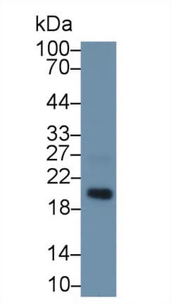 MFAP5 / MAGP2 Antibody (aa25-152, APC)