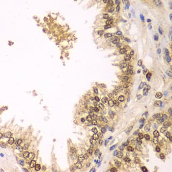 BCL2 / Bcl-2 Antibody