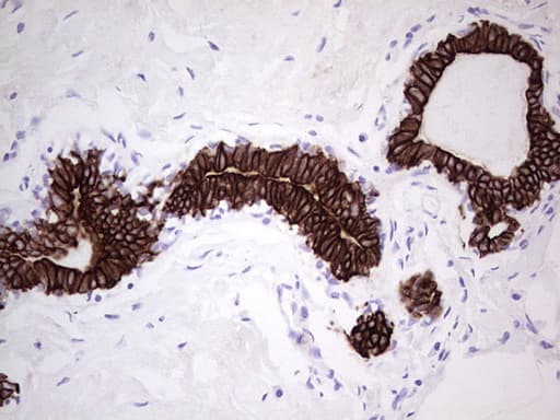 KRT19 / CK19 / Cytokeratin 19 Antibody (aa240-390, clone UMAB186, Carrier-free)