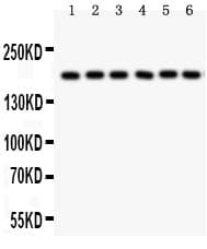 PAPPA / PAPP-A Antibody (aa95-388)