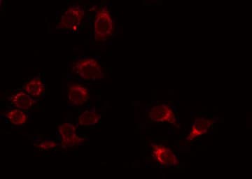 ADGRB1 / BAI1 Antibody