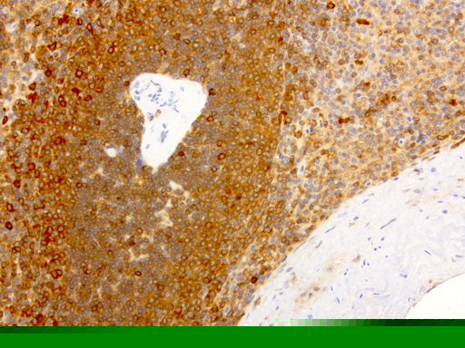 NME1 / NM23 Antibody (clone UMAB94)