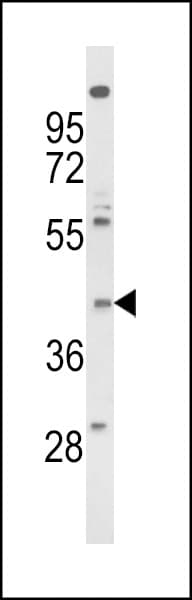 FPR3 / FPRL2 Antibody (aa307-333)