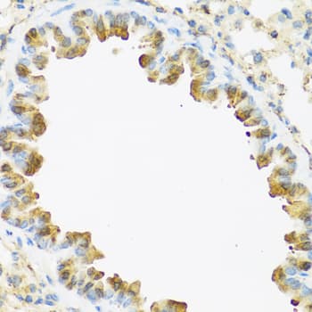 S100A7 / Psoriasin Antibody