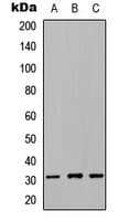 NRIP2 Antibody (N-Terminus)