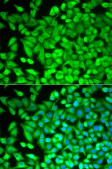Polyclonal Rabbit anti-Human FBP1 Antibody (IF, WB)