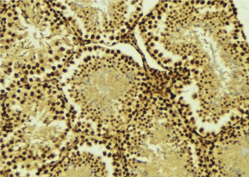 AKIP1 / BCA3 Antibody